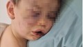 Annesinin sevgilisi dehşeti yaşattı: 2 yaşındaki bebek hastanelik oldu!