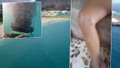 Antalya'da deniz enfeksiyonu alarmı: Denize giren çocuğun vücudu lekelerle kaplandı!