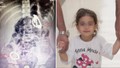 Minik Berfin'in karnından çıkanlar doktorları bile şoke etti