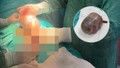 Bitmek bilmeyen ağrılarının nedenini öğrenince o da doktorlar da büyük şok yaşadı!