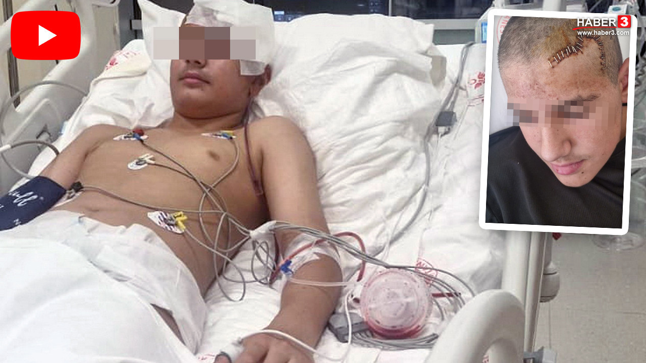 Bir akran şiddeti daha: İki minik çocuğun ''şakalaşması'' kabusa dönüştü