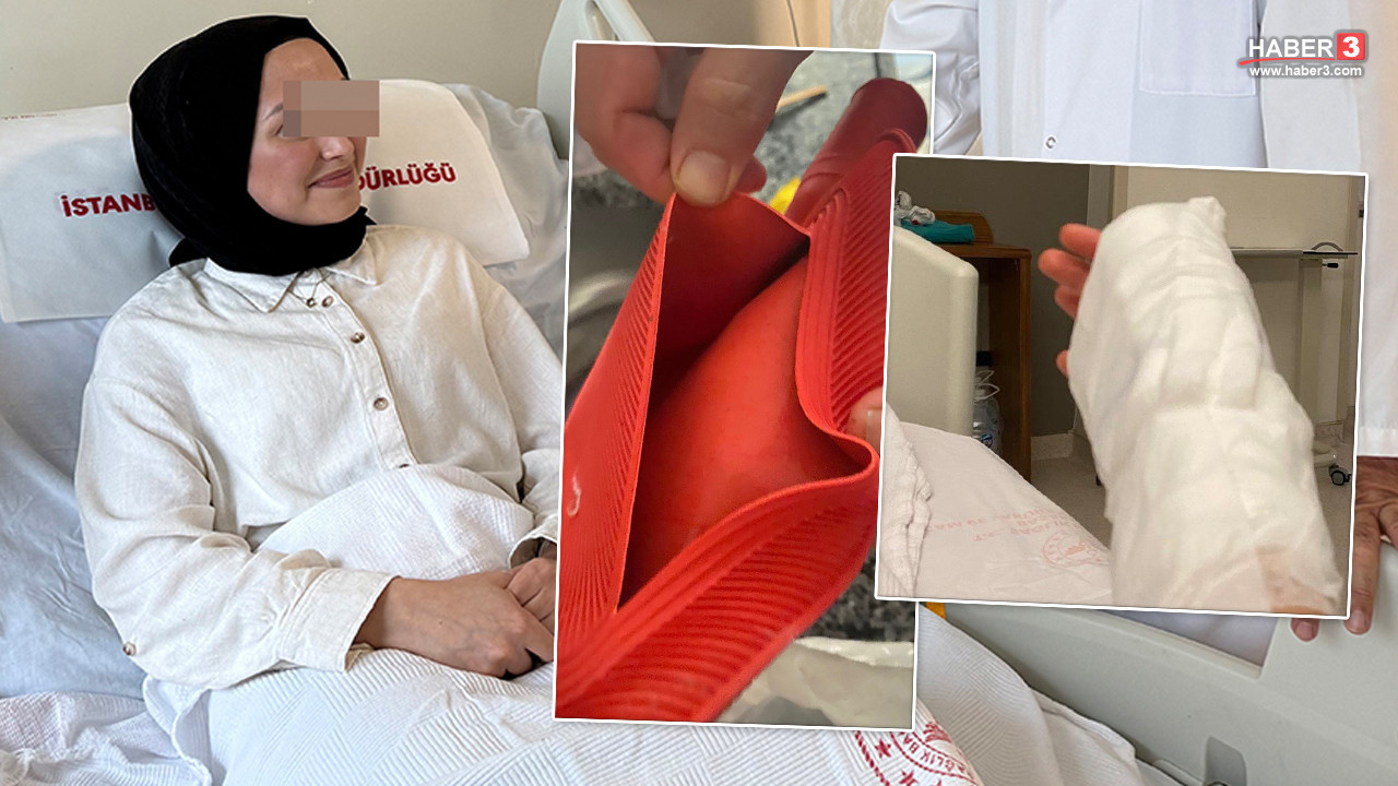 Genç kızın karnına koyduğu sıcak su torbası kabusu oldu