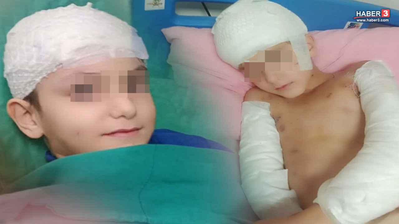 Valilik ve belediyeler sokak köpeklerinin yaraladığı çocuğun ailesine 5 milyon TL tazminat ödeyecek