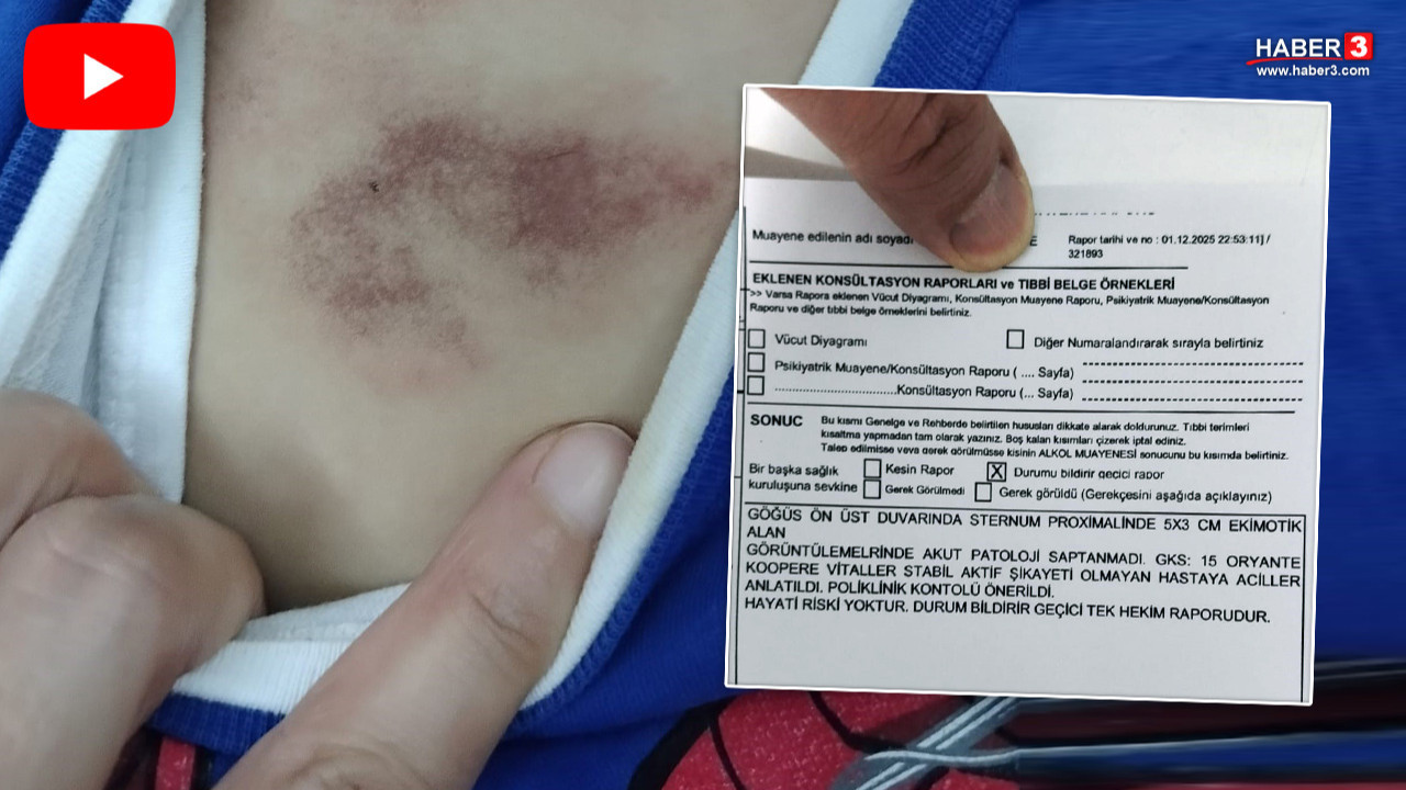 İstanbul'da belediye kreşinde istismar ve darp iddiası