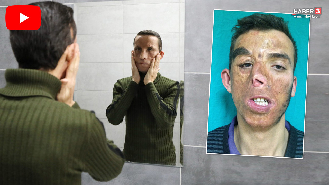 Hayatını değiştiren ameliyatla tam 14 yıldır hayata başka bir yüzle bakıyor!