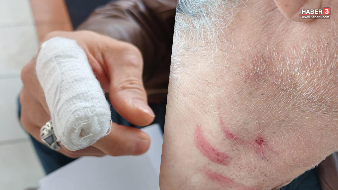 Aile Sağlığı Merkezi'nde doktora şiddet: Saldırgan müezzin çıktı!