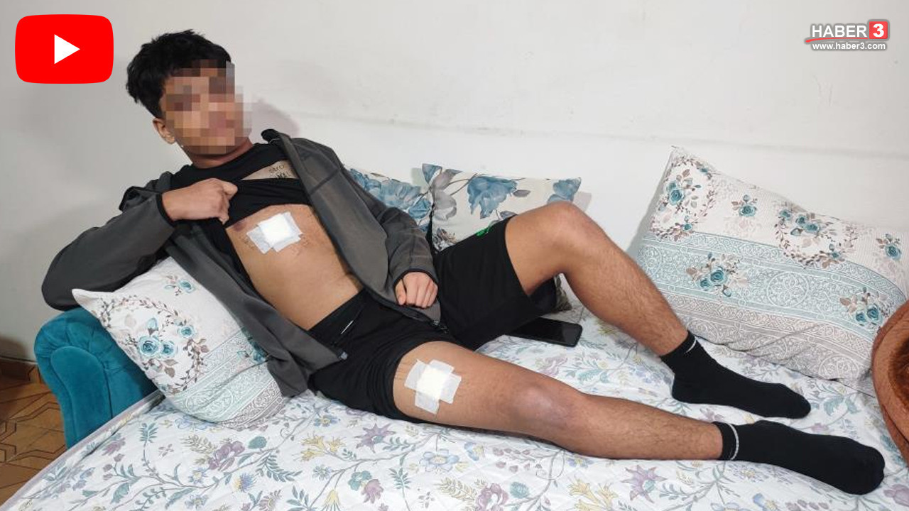 Yine akran dehşeti: 15 yaşındaki çocuk ölümden döndü!