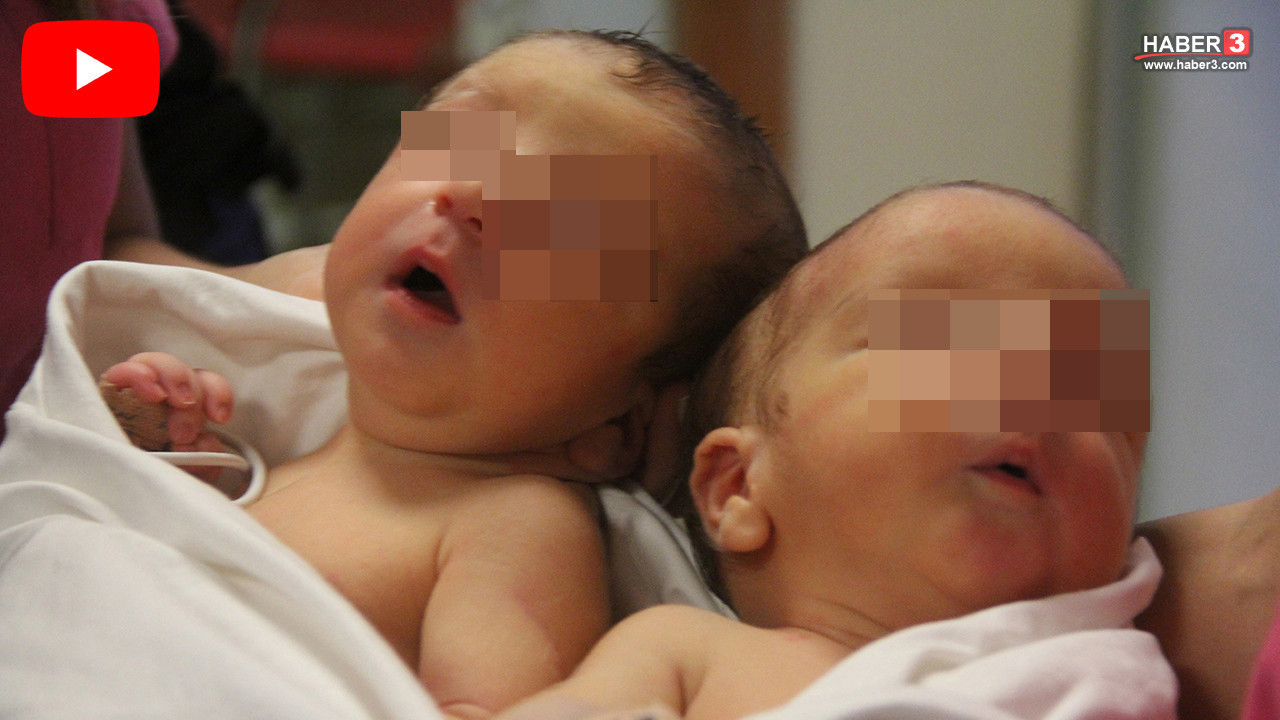 Asrın felaketinde hem öksüz hem yetim kalan siyam ikizleri bu sefer de ölüm ayırdı