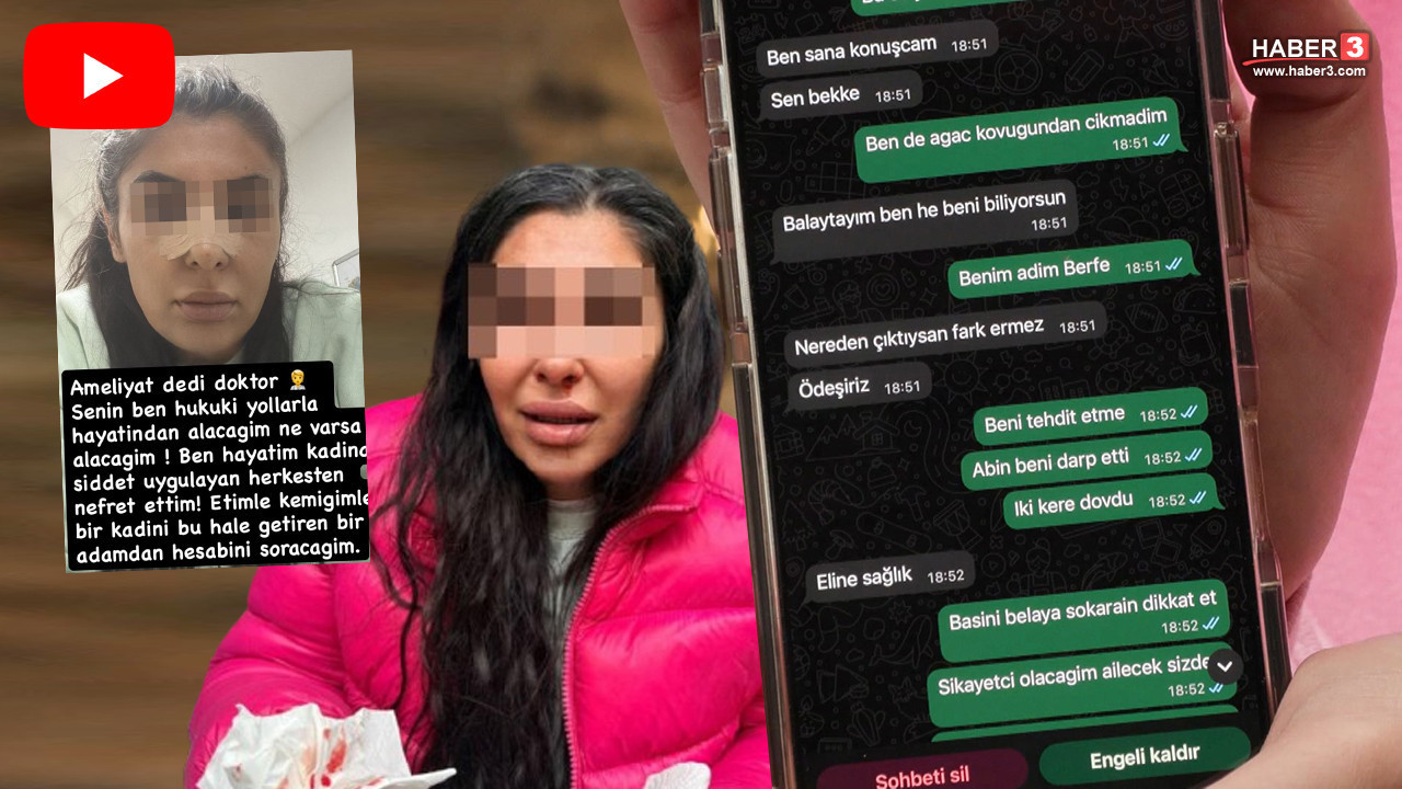 Avukat sevgili genç kadına kabusu yaşattı: Darp edip burnunu kırdı