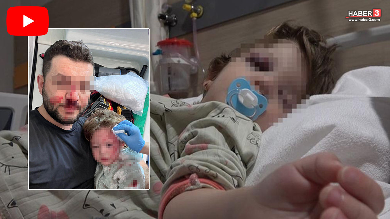 Baba ile 14 aylık bebeğini darbeden saldırganların ifadesi ortaya çıktı