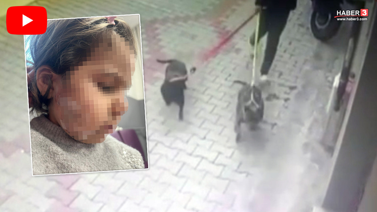 Apartman bahçesinde pitbull vahşeti: 3 yaşındaki çocuğun yüzünü parçaladılar!