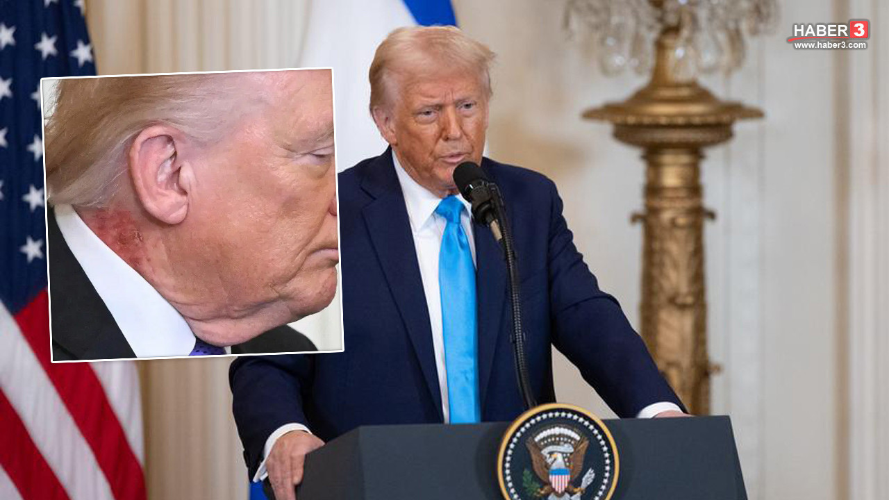 Trump'ın bu görüntü dikkat çekti; açıklama doktorundan geldi