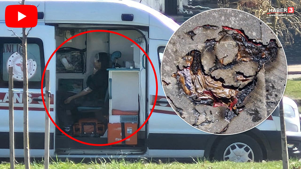 Çocukların parktaki oyunu kabusa döndü: İki çocuk alevler içinde kaldı