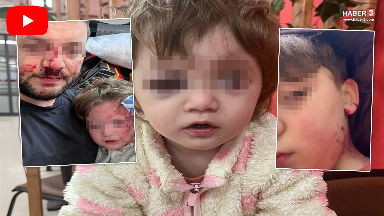Kucağında bebeği ile darbedilen babanın 8 yaşındaki oğlu da saldırıya uğradı