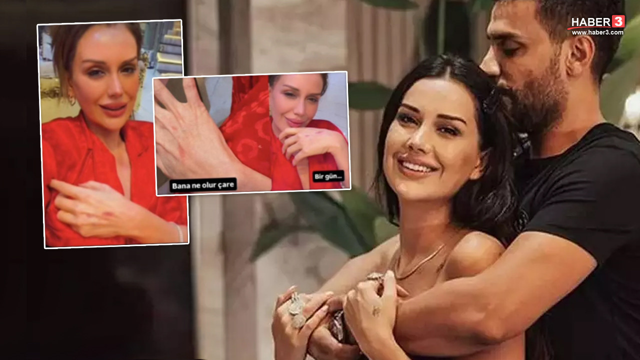 Dilan Polat'tan korkutan paylaşım! Ellerinin hali dehşete düşürdü: ''Bana ne olur bir çare...''