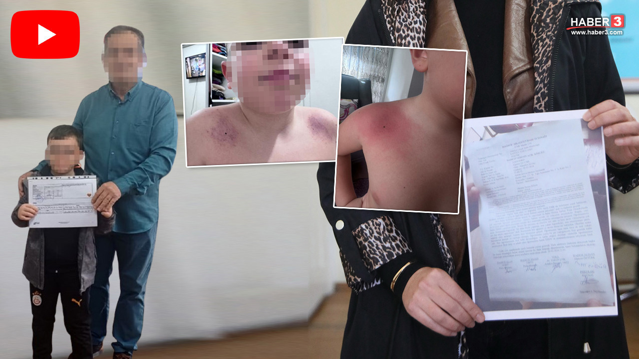 İlkokulda 8 yaşındaki minik çocuğa öğretmen şiddeti iddiası: Darp izleri kan dondurdu!
