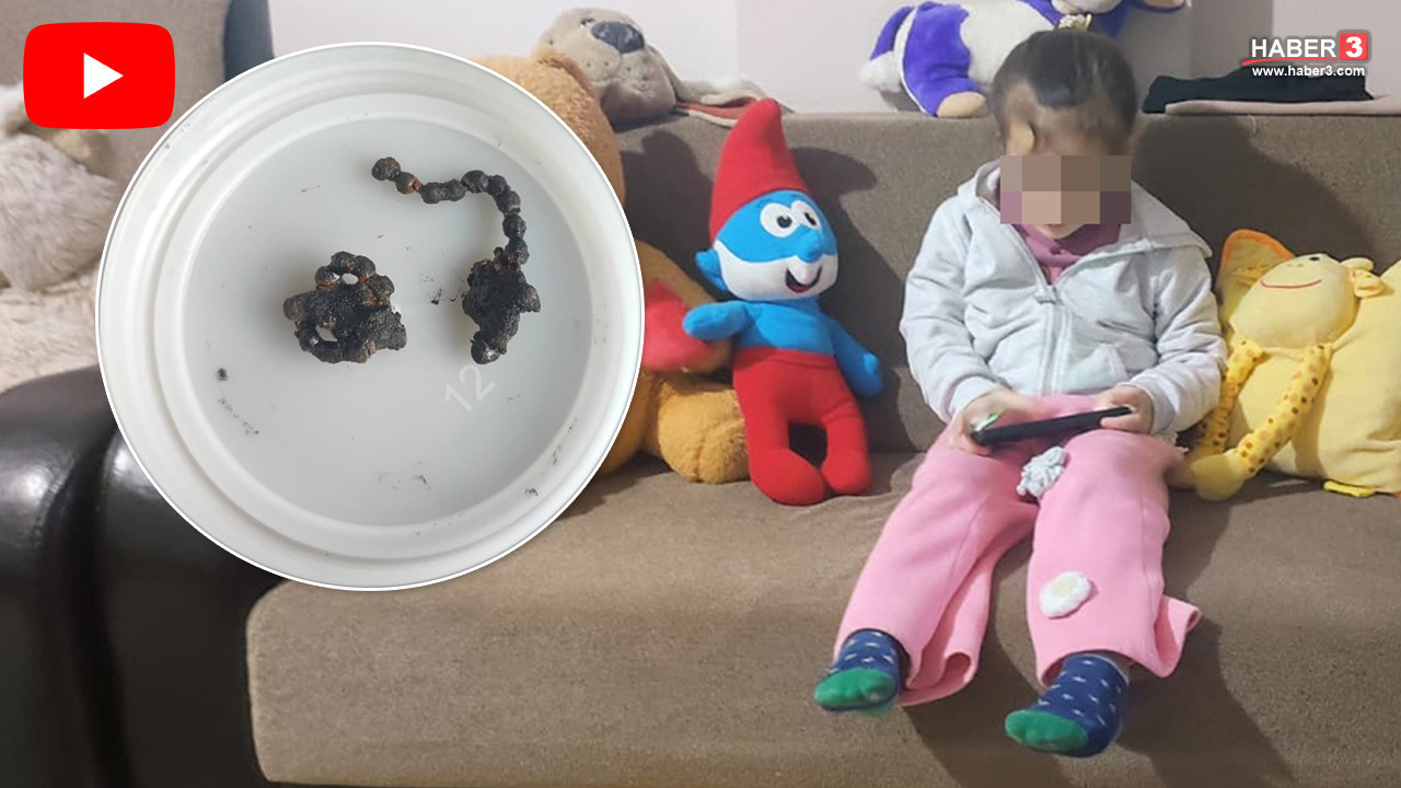 Bir sağlık skandalı daha: 5 yaşındaki minik Polen'in burnundan 2 yıllık zincir çıktı