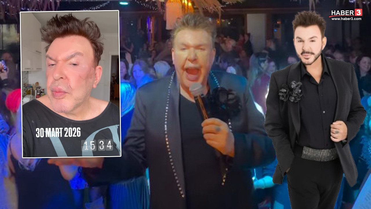 Kuşum Aydın’dan yüz gerdirme ameliyatı sonrası ilk kare... Gören tanıyamadı