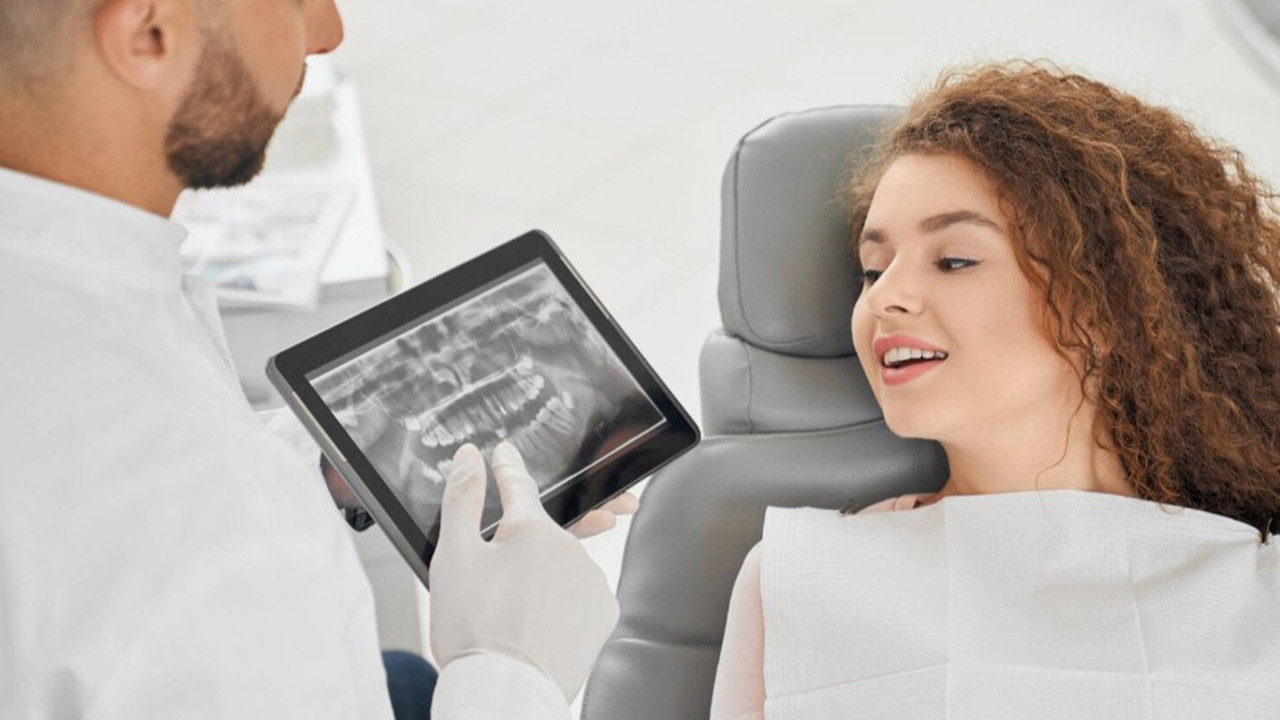 Diş İmplant Tedavisi Son Yıllarda Neden Popüler Oldu?