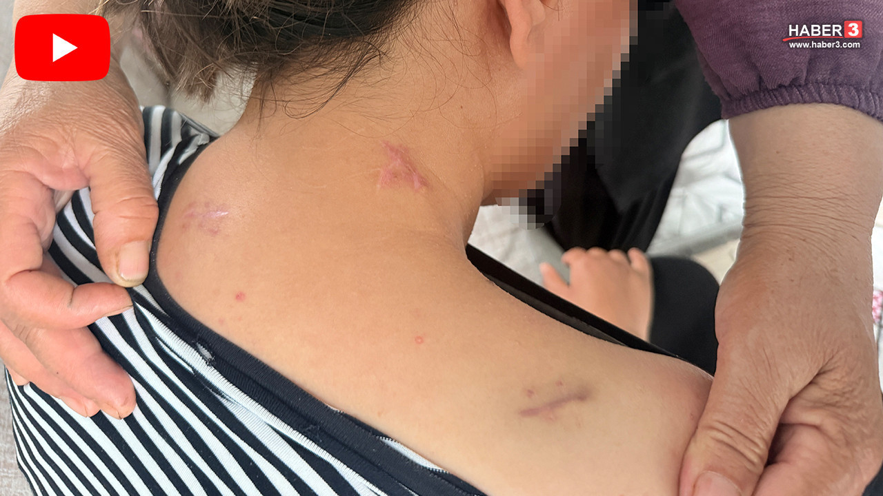 Bir anne çocuklarının gözü önünde 17 kez bıçaklandı, ölü numarasıyla hayata tutundu!
