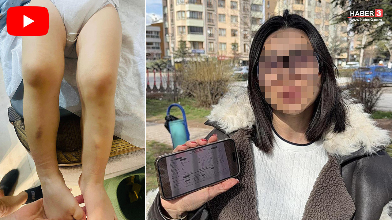 Kreşte skandal iddia: Darp raporuyla soluğu savcılıkta aldı