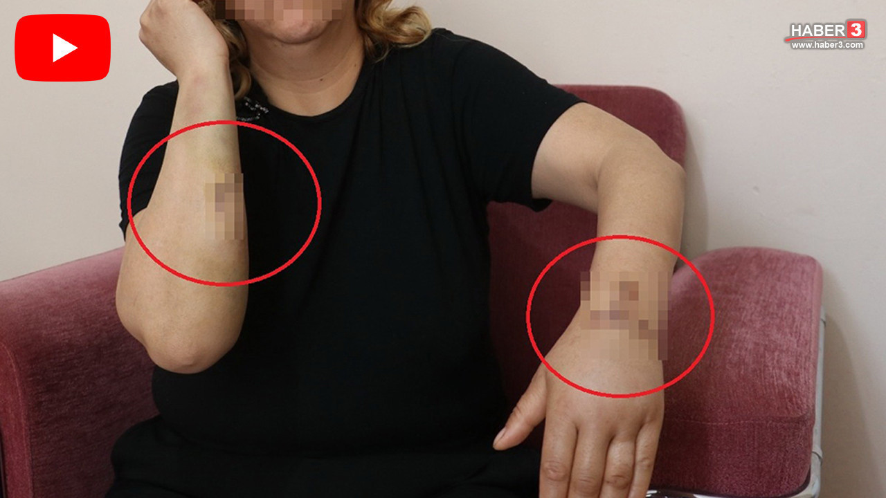 16 yıl birlikte yaşadığı cani ona kabusu yaşattı: 30 bıçak darbesiyle hayatta kaldı!