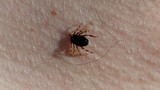Türkiye'nin sessiz katilleri için Japonya'dan çok özel bir ekip geldi!