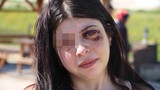 Genç kadın sokak ortasında dehşeti yaşadı! Ömür boyu böyle yaşayacak...