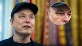 Elon Musk'ın yüzündeki morluğun sebebi belli oldu