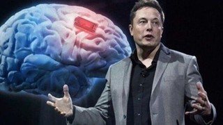 ABD'den Elon Musk'ın beyin çipi projesine ret