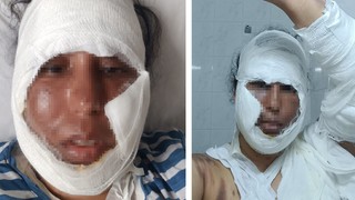 Gelin - görümce kavgasının sonu korkunç bitti