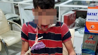 Antalya'da günlerce işkenceye Adli Tıp raporu şoke etti