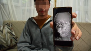 Sokak magandaları yüzünden 1,5 yıldır her gün ölüm korkusuyla yaşıyor!