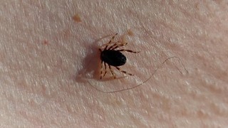 Türkiye'nin sessiz katilleri için Japonya'dan çok özel bir ekip geldi!