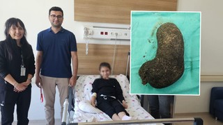 İştahsızlık ve mide ağrısı yaşayan küçük kızın karnından çıkanlar şoke etti