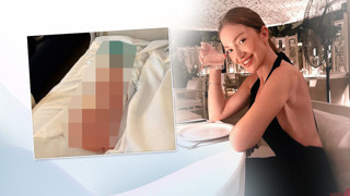 Kalça dolgusu itirafı olay olan Danla Bilic vücudundan çıkan dolgu malzemesini yayınladı!