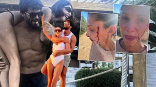 Can Yaman'ın sevgilisi Sara Bluma ''şiddet görüyorum'' deyip kanlar içinde paylaşım yaptı