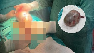 Bitmek bilmeyen ağrılarının nedenini öğrenince o da doktorlar da büyük şok yaşadı!
