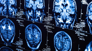 Covid-19 pandemisinin gizli etkisi 5 yıl sonra ortaya çıktı