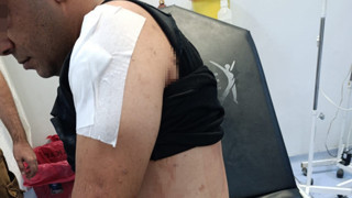 İş görüşmesi diye gitmişti, saldırıya uğrayıp ölümden döndü!