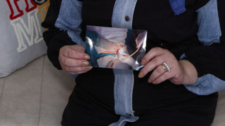 İstanbul'da bir özel hastanede saç baş yolduran ameliyat skandalı!