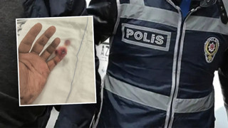 Gözaltına alınırken polisin parmağını kopardı