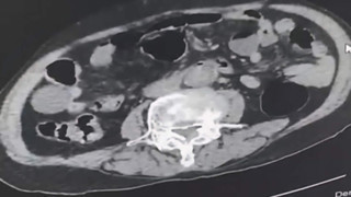 Cinsel organından uyuşturucu çıktı