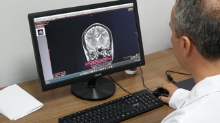 Türkiye'de de vaka sayısı hızla artan çağın yeni kabusu için kritik uyarı