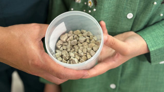 Genç kadının vücudundan çıkanlar doktorları da şoke etti!