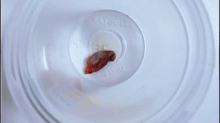 1.5 yıldır geçmek bilmeyen öksürüğün nedeni şaşırttı