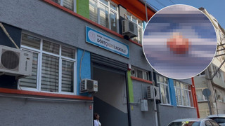 İlkokulda kan donduran olay: Çocuğun parmağı koptu, ders devam etti