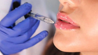 Dudak Dolgusu Fiyatları ve Kalıcılığı Hakkında Merak Edilenler