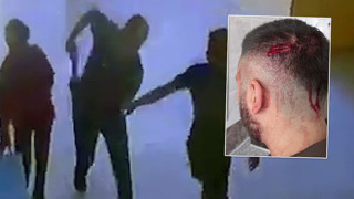 Öğretmene okulda veliden demirle saldırı kamerada: Öğretmenin kavası yarıldı!