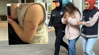 Kreşte kabus! Bir öğretmen 3 yaşındaki miniği ısırıp hastanelik etti!